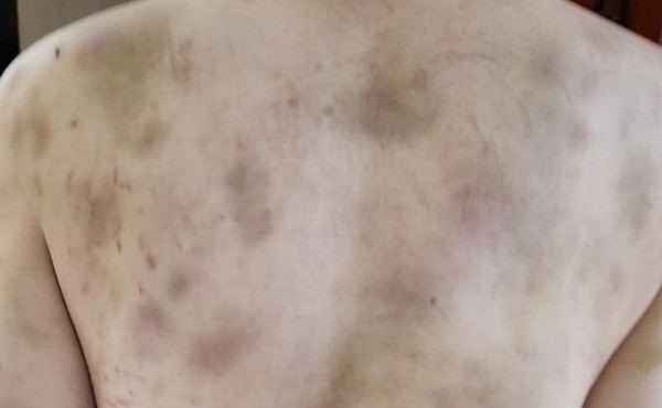 �������� 2�Ⱓ ��Ÿ�����ڡ� �߽Ĵ� ���� �¸� �������̿���